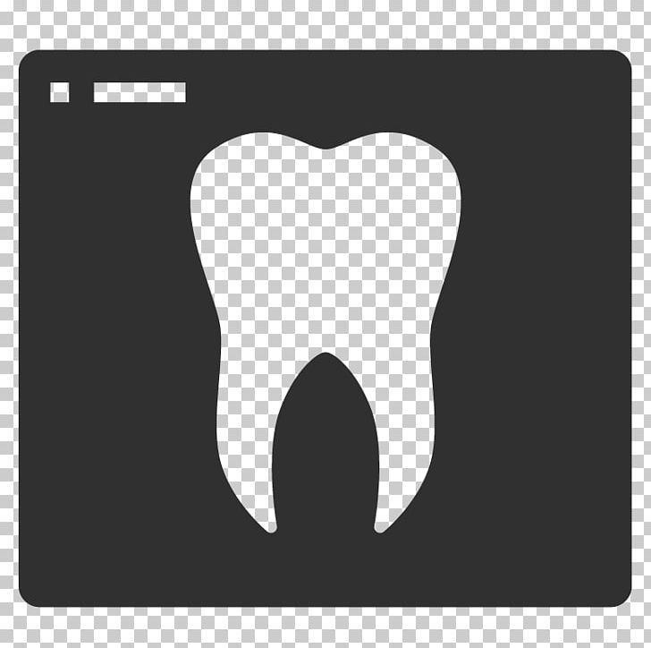 Tooth Dentistry Crown Orthodontics PNG, Clipart, Black, Black And White, Crown, Delicate Dental Family Dentistry, Dental Impression Free PNG Download