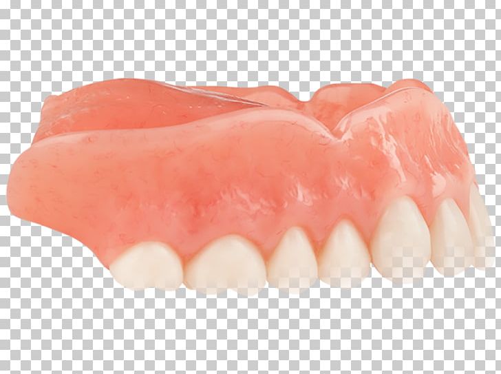 Tooth Dentures PNG, Clipart, Arrow, Aspen, Dental, Dentures, Each Free PNG Download