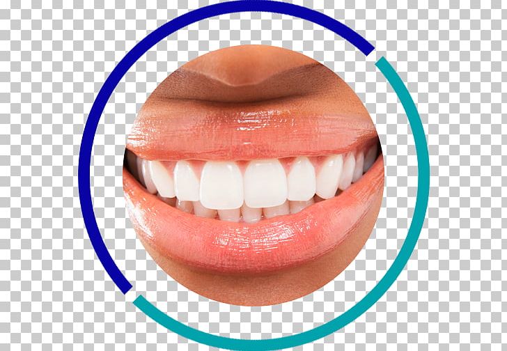 Tooth Whitening Dentistry Human Tooth PNG, Clipart, Chin, Cosmetic Dentistry, Dental Implant, Dentist, Dentistry Free PNG Download