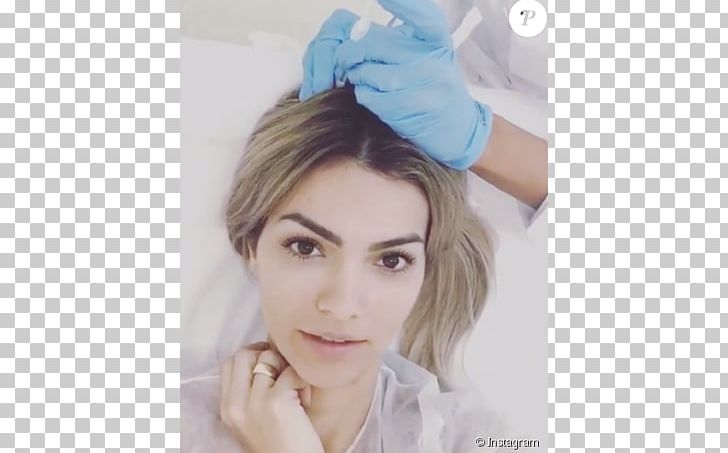 Kelly Key Injection Mesotherapy Head Hair PNG, Clipart, Actor, Beauty, Eyebrow, Eyelash, Forehead Free PNG Download