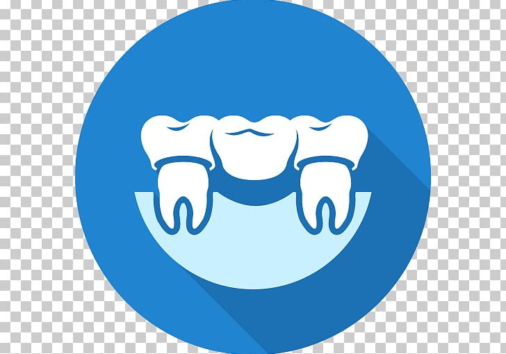 Dentistry Bridge Crown Dental Implant PNG, Clipart, Area, Blue, Bridge, Circle, Cosmetic Dentistry Free PNG Download