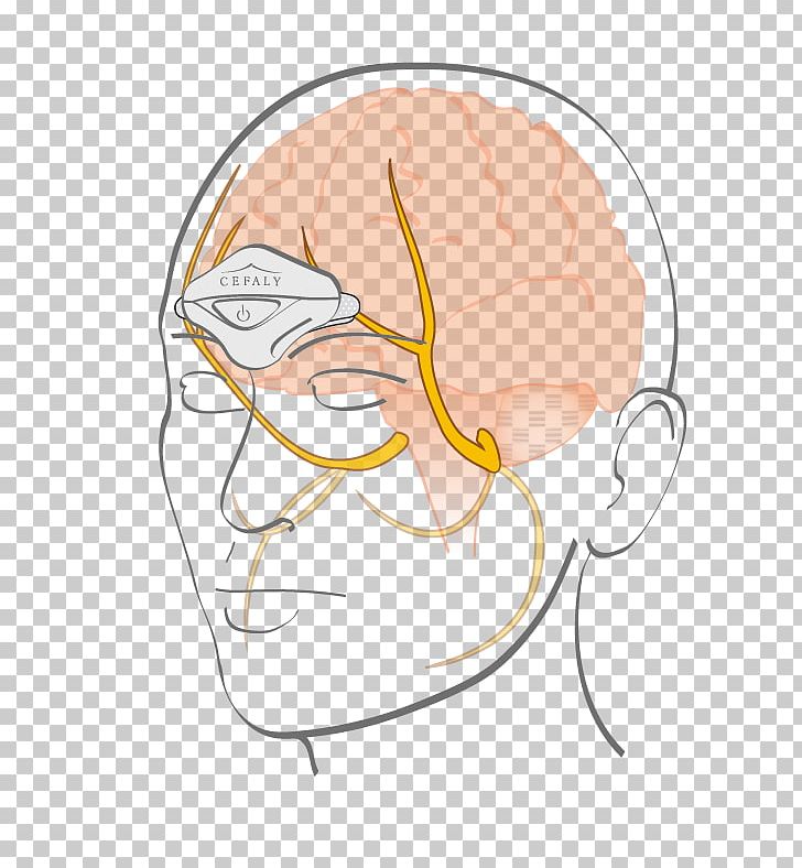 Cefaly Electrode Trigeminal Nerve Migraine Trigeminal Neuralgia PNG, Clipart, Bone, Brain, Cartoon, Chee, Eye Free PNG Download