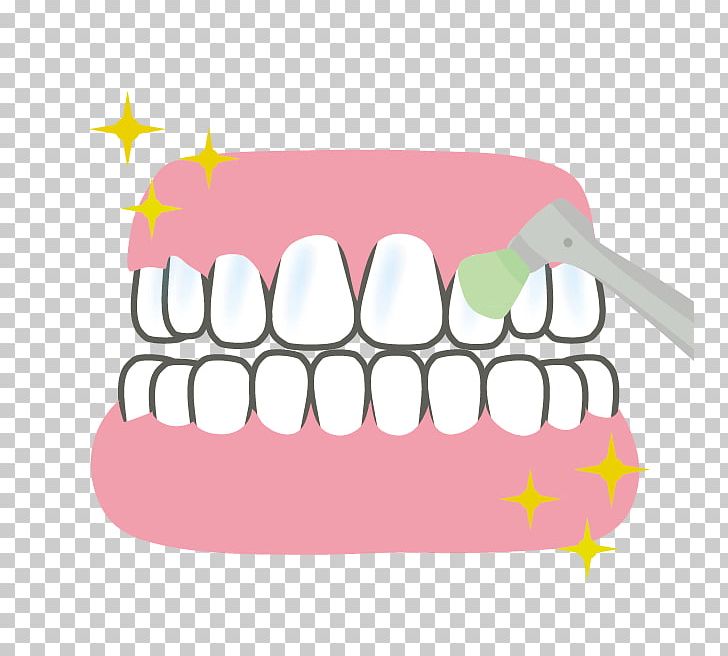 Tooth Dentures Dentist 歯科 Dental Plaque PNG, Clipart, Dental Plaque, Dentist, Dentures, Eyelash, Hospital Free PNG Download