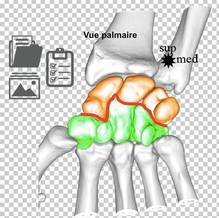 Thumb Ulnar Nerve Wrist Joint Human Anatomy PNG, Clipart, Abdomen, Area, Arm, Arthrology, Bone Free PNG Download