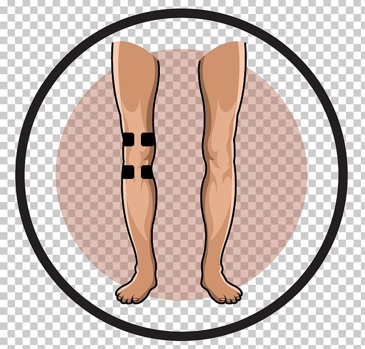 Finger Knee Pain Transcutaneous Electrical Nerve Stimulation Electrical Muscle Stimulation PNG, Clipart, Arm, Calf, Ear, Electrical Muscle Stimulation, Electrode Free PNG Download