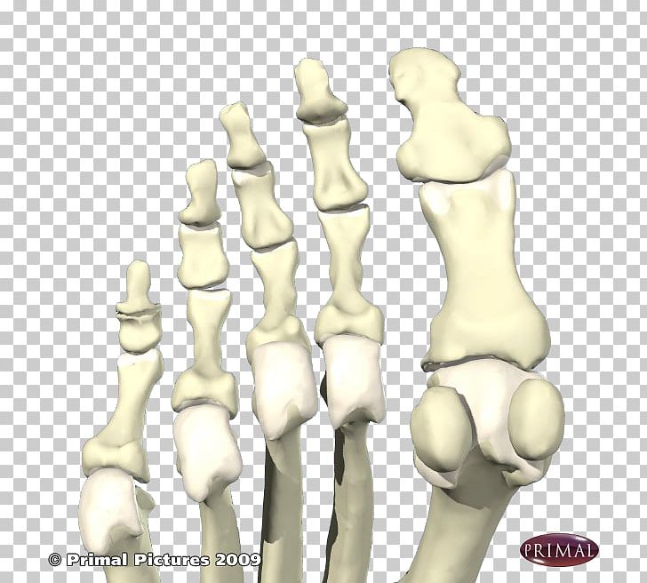 Finger Sesamoid Bone Foot First Metatarsal Bone PNG, Clipart, Arm, Bone, Bone Fracture, Finger, First Metatarsal Bone Free PNG Download