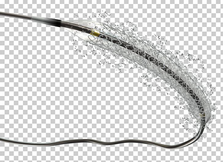 Drug-eluting Stent Stenting Coronary Stent Sirolimus Bioresorbable Stent PNG, Clipart, Angioplasty, Balloon Catheter, Biodegradable Polymer, Bioresorbable Stent, Cardiology Free PNG Download
