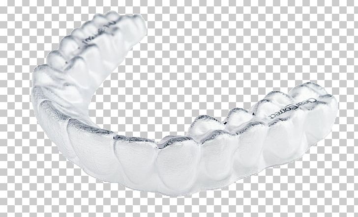 Cosmetic Dentistry Clear Aligners Orthodontics PNG, Clipart, Body Jewelry, Bracelet, Chain, Clear Aligners, Cosmetic Dentistry Free PNG Download