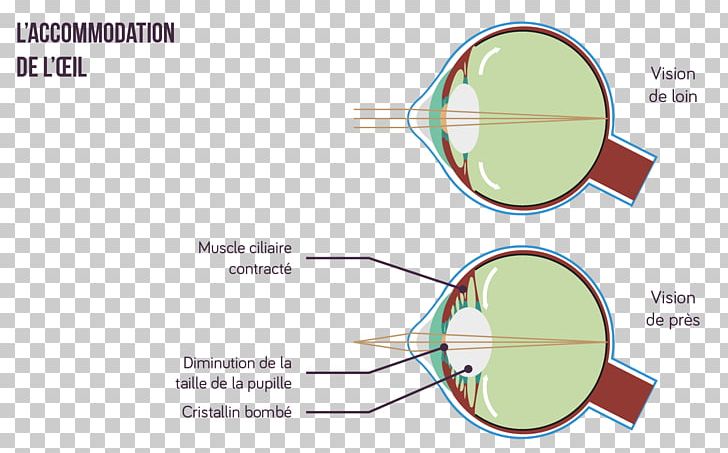Glasses Accommodation Eye Lens Light PNG, Clipart, Accommodation, Angle, Area, Brand, Ciliary Body Free PNG Download