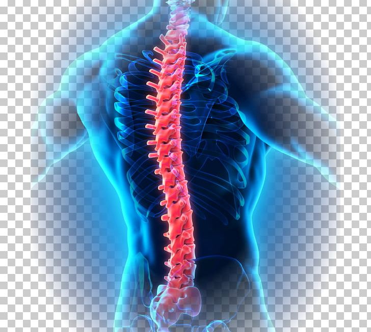 Surgery Medicine Therapy Disease Ankylosing Spondylitis PNG, Clipart, Anatomy, Arthritis, Back Pain, Closeup, Computer Wallpaper Free PNG Download