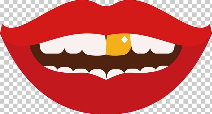 Human Tooth Gold Teeth Computer Icons PNG, Clipart, Computer Icons, Dental Public Health, Dentistry, Facial Expression, Fang Free PNG Download