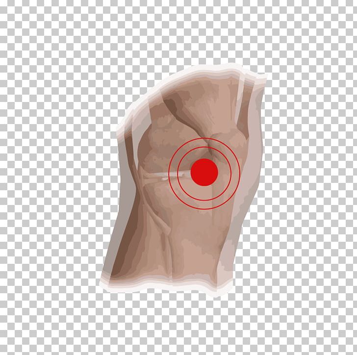 Knee Silkeborg Meniscus Anterior Cruciate Ligament Metal Gear Rising: Revengeance PNG, Clipart, Anesthesia, Anterior Cruciate Ligament, Beige, Butuan, Ear Free PNG Download