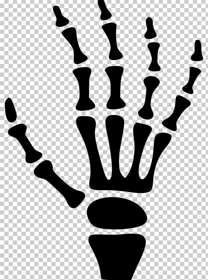 Carpal Bones Human Skeleton Hand PNG, Clipart, Black And White, Bone, Carpal Bones, Cdr, Computer Icons Free PNG Download