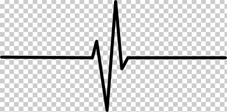 Electrocardiography Heart Rate Pulse PNG, Clipart, Angle, Autocad Dxf, Black And White, Desktop Wallpaper, Electrocardiography Free PNG Download