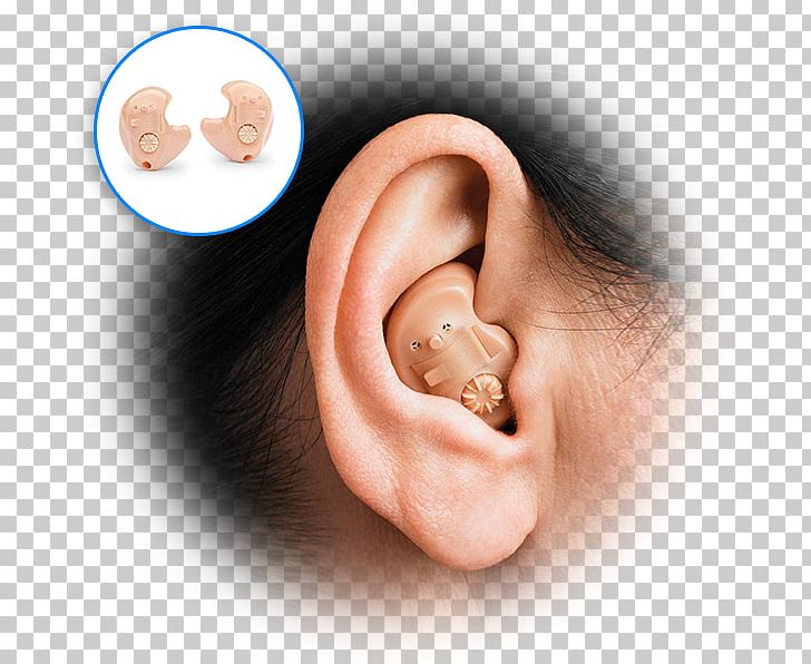 Digital Hearing Aids Audiology Ear Canal PNG, Clipart, Audiology, Audiometer, Chin, Closeup, Ear Free PNG Download