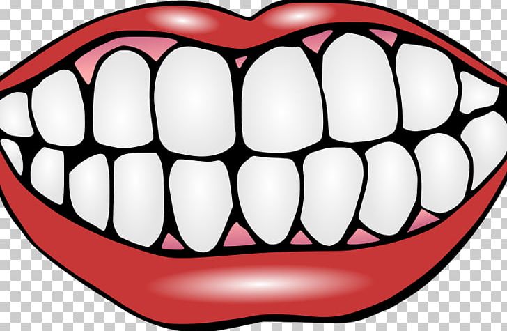 Human Tooth Tooth Decay PNG, Clipart, Cartoon Mouth, Dentist, Dentistry, Facial Expression, Homo Sapiens Free PNG Download