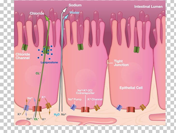 Constipation Lactulose Lactose Intolerance Irritable Bowel Syndrome Symptom Png Clipart Adverse Effect Anorexia Brand Colitis Constipation