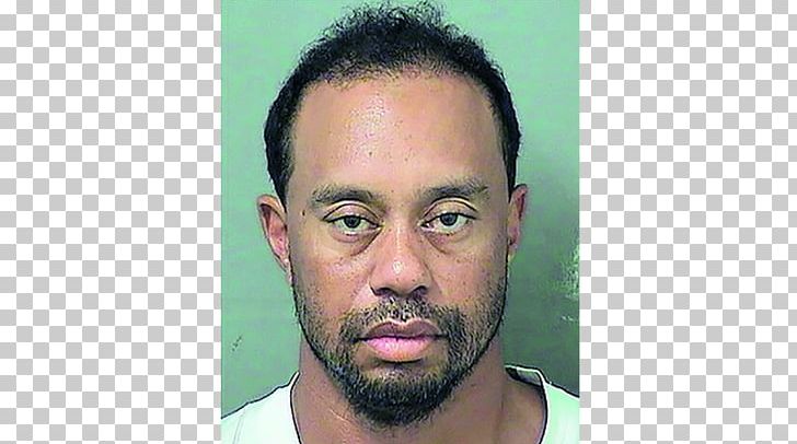 Tiger Woods Florida The US Open (Golf) Arrest PNG, Clipart, Arrest, Beard, Cheek, Chin, Driving Under The Influence Free PNG Download
