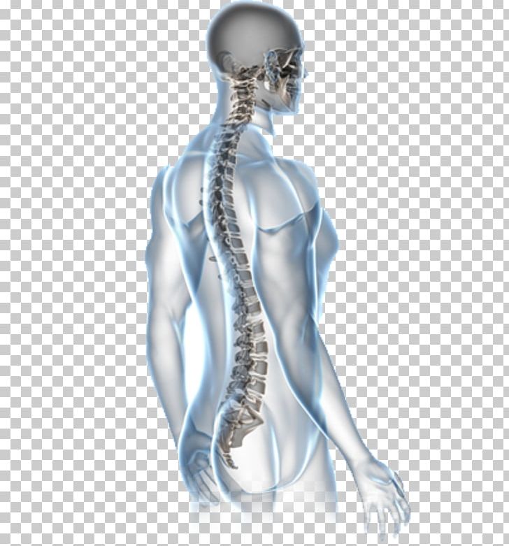 Back Pain Surgery Human Back Vertebral Column Chiropractic PNG, Clipart, Ache, Arm, Back, Health, Health Care Free PNG Download