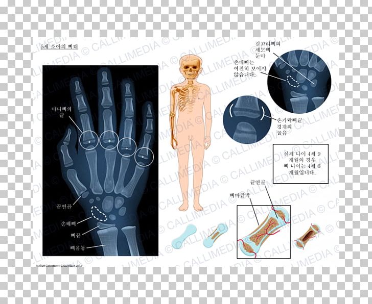 Pediatrics Medicine PNG, Clipart, Arm, Bone, Bone Fracture, Dyspnea, Esqueleto Free PNG Download