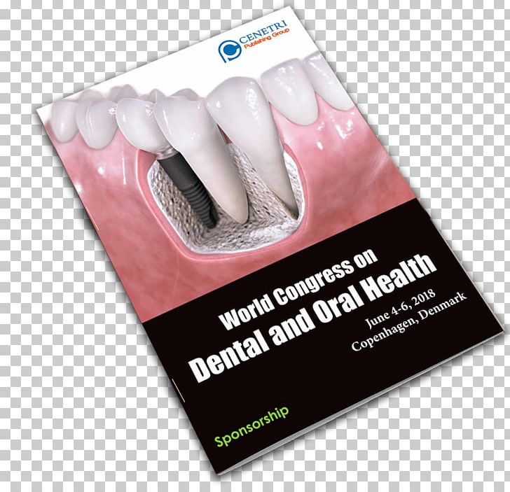Controversial Issues In Implant Dentistry Advertising PNG, Clipart, Advertising, Art, Craniofacial Surgery, Dental Implant, Dentistry Free PNG Download