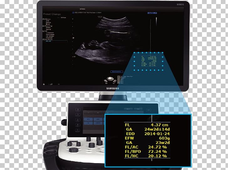 3D Ultrasound Samsung Medison Ultrasonography Consumer Electronics PNG, Clipart, 3d Ultrasound, Consumer Electronics, Contrastenhanced Ultrasound, Display Device, Electronics Free PNG Download