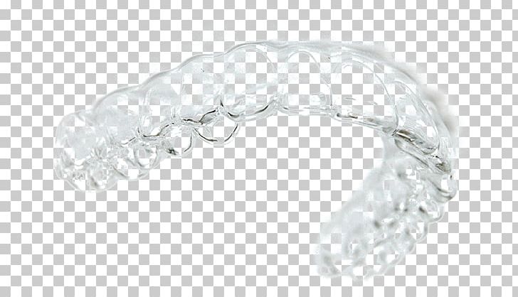Orthodontics Clear Aligners Элайнер Dentistry Jaw PNG, Clipart, Body Jewellery, Body Jewelry, Bone, Bracelet, Clear Aligners Free PNG Download