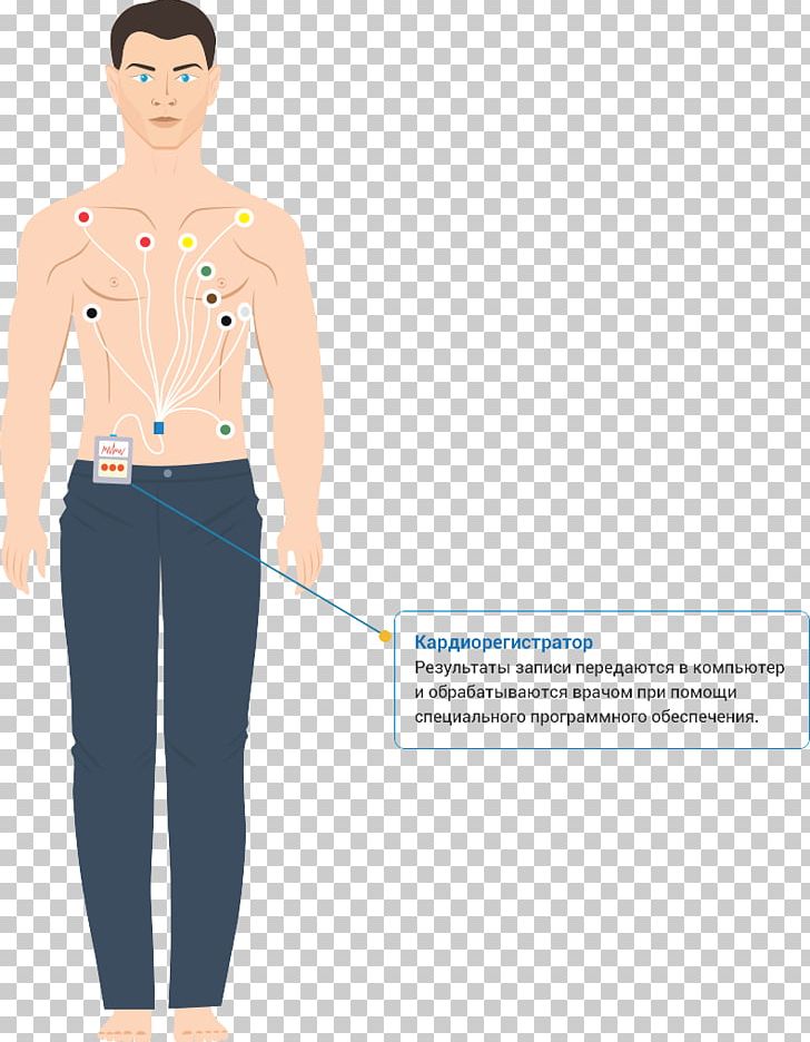 Holter Monitor Hypertension Electrocardiography Cardiovascular Disease Medical Diagnosis PNG, Clipart, Abdomen, Arm, Cardiovascular Disease, Cirrhosis, Ekg Free PNG Download