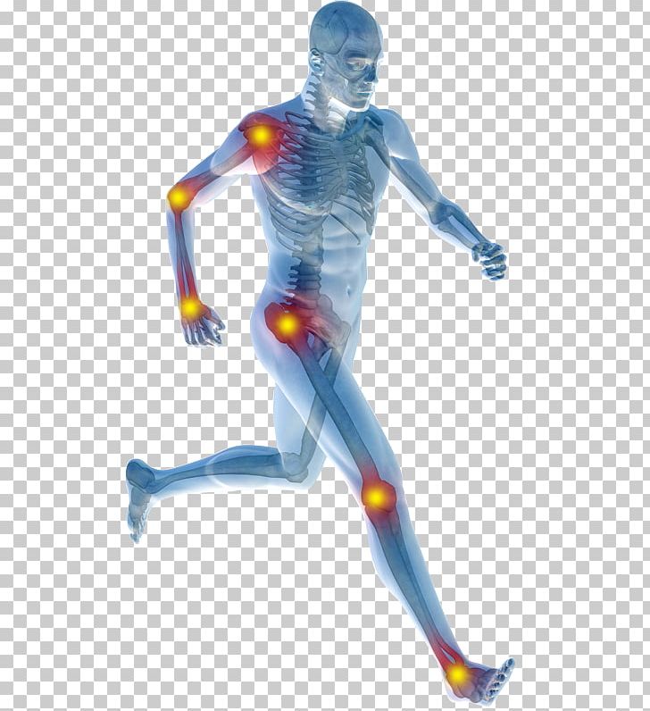Physical Therapy Transcutaneous Electrical Nerve Stimulation Back Pain Sports Injury Strain PNG, Clipart, Arm, Arthritis, Bone, Figurine, Foot Free PNG Download