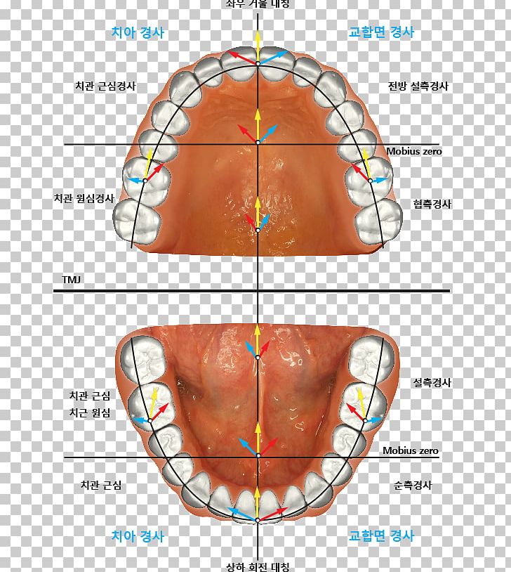Jaw Dental Implant Occlusion Tooth PNG, Clipart, Abdomen, Anatomy, Angle, Area, Canine Tooth Free PNG Download
