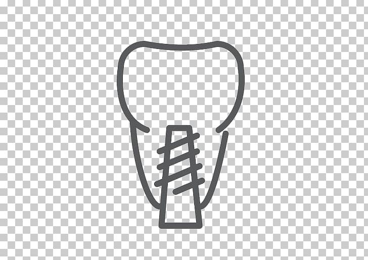 Dental Implant Dentistry Dental Surgery PNG, Clipart, Angle, Black And White, Clinic, Cosmetic Dentistry, Crown Free PNG Download