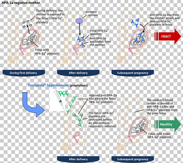 Rho(D) Immune Globulin Rh Blood Group System Antibody RHD Red Blood Cell PNG, Clipart, Antigen, Area, Blood, Hand, Human Body Free PNG Download