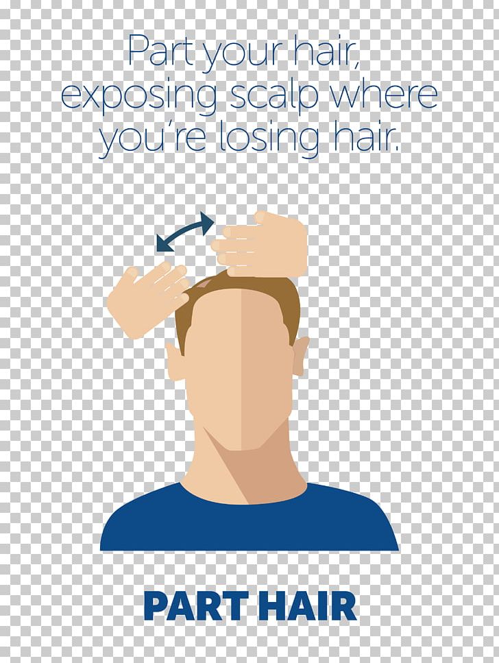 Minoxidil Scalp Management Of Hair Loss PNG, Clipart, Area, Black Hair, Brand, Communication, Conversation Free PNG Download