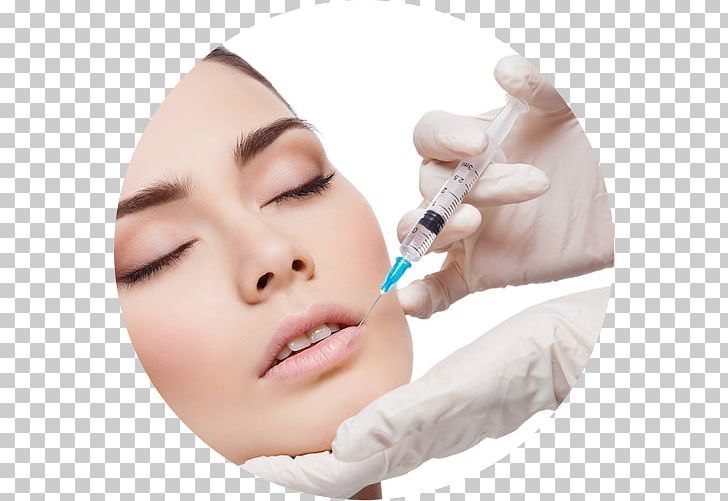 Injection Lip Surgery Skin Adverse Effect PNG, Clipart, Baby Bottle, Beauty, Cheek, Chin, Cosmetic Dentistry Free PNG Download