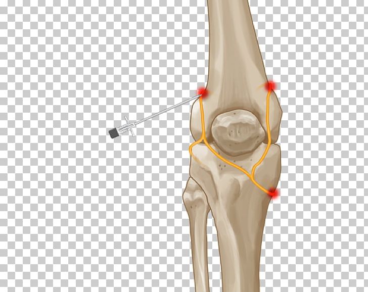 Knee Pain Thumb Joint Hip PNG, Clipart, Ache, Arm, Bone, Cambridge Consultants, Descending Genicular Artery Free PNG Download