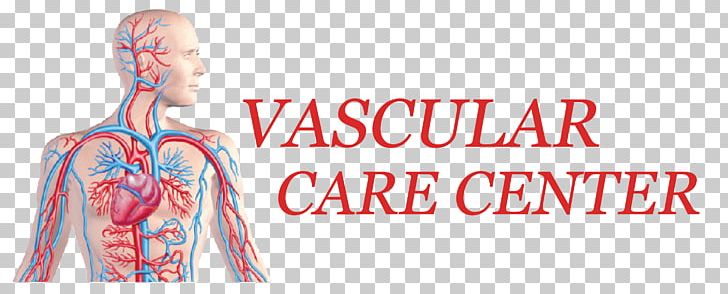 Endovascular Surgery Medicine Varicose Veins PNG