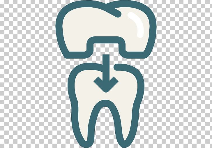 Dentistry Crown Dental Implant Veneer PNG, Clipart, Aqua, Area, Bridge, Cadcam Dentistry, Cosmetic Dentistry Free PNG Download