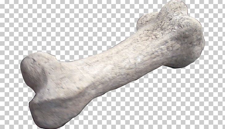 Apatosaurus Dinosaur Bones Fossil PNG, Clipart, Animal, Apatosaurus, Bone, Bone Cancer, Bone Fracture Free PNG Download