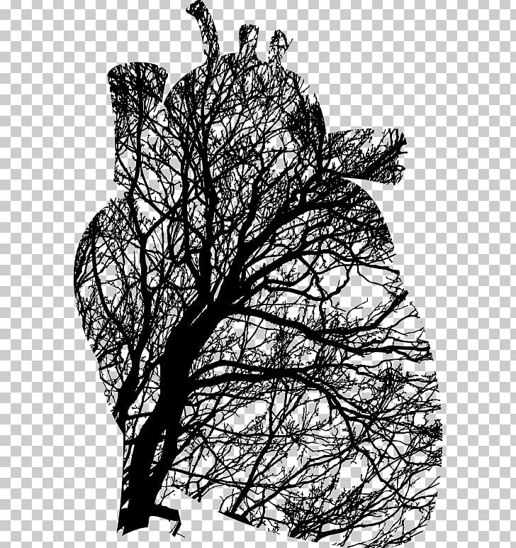 Heart Tree Branch Cardiovascular Disease PNG, Clipart, Aorta, Black And White, Branch, Cardiovascular Disease, Computer Icons Free PNG Download