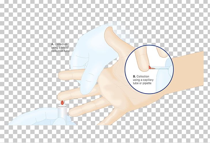 Thumb Medical Glove Product Hand Model PNG, Clipart, Arm, Ear, Finger, Glove, Hand Free PNG Download