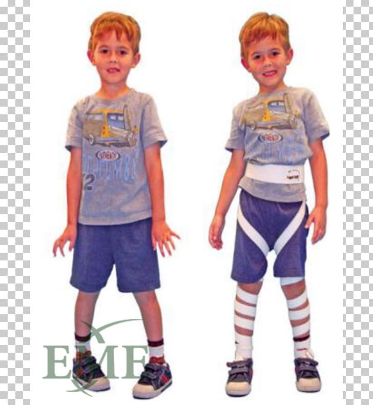 Orthotics Splint Therapy Reciprocating Gait Orthosis PNG, Clipart, Abdomen, Boy, Cerebral Palsy, Cervical Collar, Child Free PNG Download