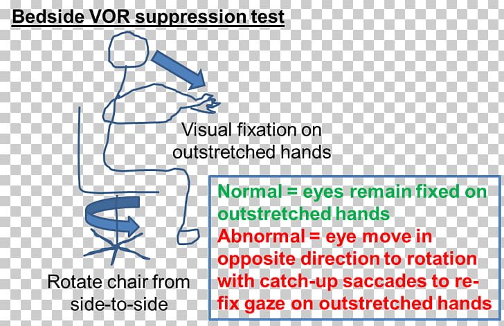 Vestibulo–ocular Reflex Saccade Eye Movement Nystagmus Vestibular System PNG, Clipart, Angle, Area, Brand, Diagram, Document Free PNG Download