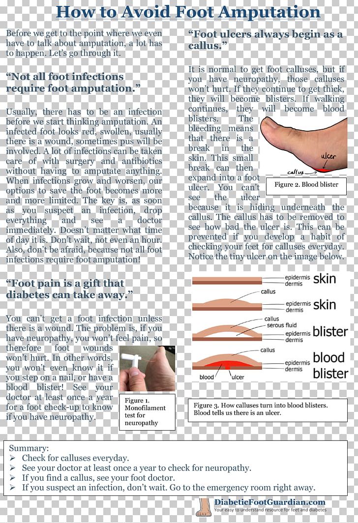 Podiatry Podiatrist Plantar Fasciitis Pirogoff-Amputation PNG, Clipart, Albuquerque, Amputation, Area, Blog, Diabetes Mellitus Free PNG Download