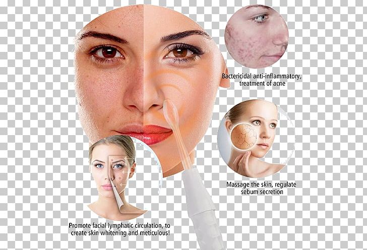 Facial Acne Wrinkle Skin Care Pimple PNG, Clipart, Acne, Beauty, Beauty Parlour, Cheek, Chin Free PNG Download