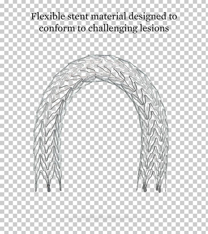Stenting Vascular Surgery Atherectomy Coronary Stent PNG, Clipart, Abbott Laboratories, Angle, Arch, Artery, Atherectomy Free PNG Download