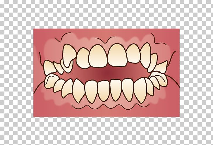 矯正歯科 Dental Braces Dentist Therapy Dentition PNG, Clipart, Cheek, Clear Aligners, Dental Braces, Dental Surgery, Dentist Free PNG Download