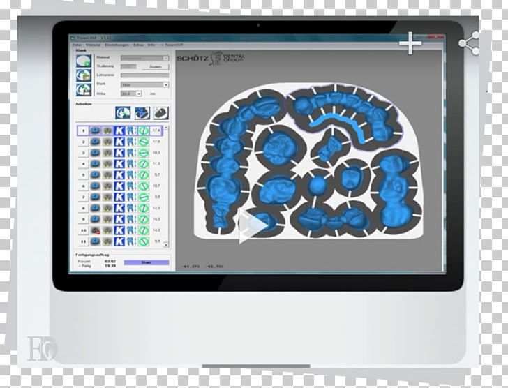 CAD/CAM Dentistry Computer-aided Design Computer-aided Manufacturing Siemens NX Computer-aided Engineering PNG, Clipart, Brain, Brand, Cad, Cad Cam, Cadcam Dentistry Free PNG Download