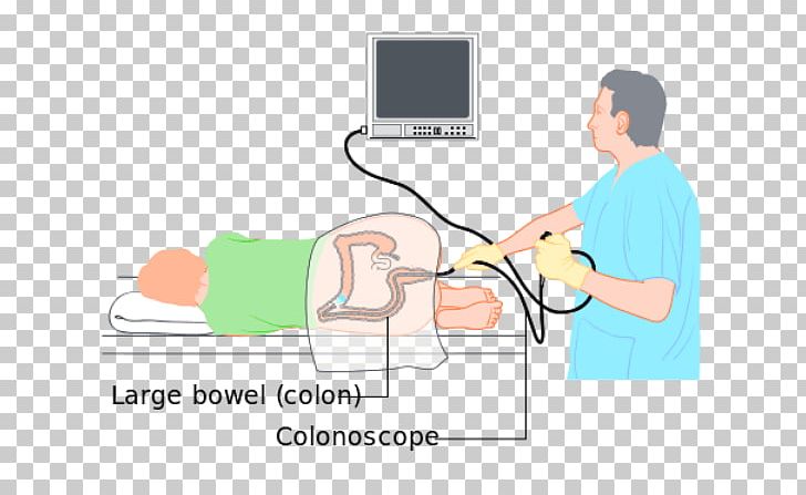Colonoscopy Wiring Diagram Large Intestine Diverticulosis PNG, Clipart,  Free PNG Download