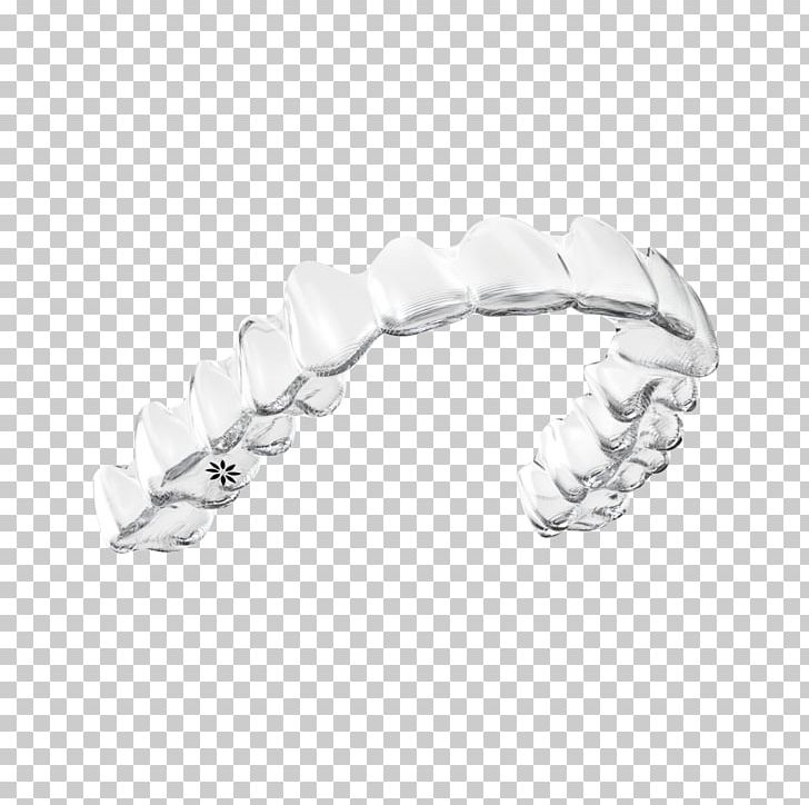 Clear Aligners Orthodontics Dentistry Align Technology Dental Braces PNG, Clipart, Align Technology, Body Jewelry, Bracelet, Braces, Cadcam Dentistry Free PNG Download