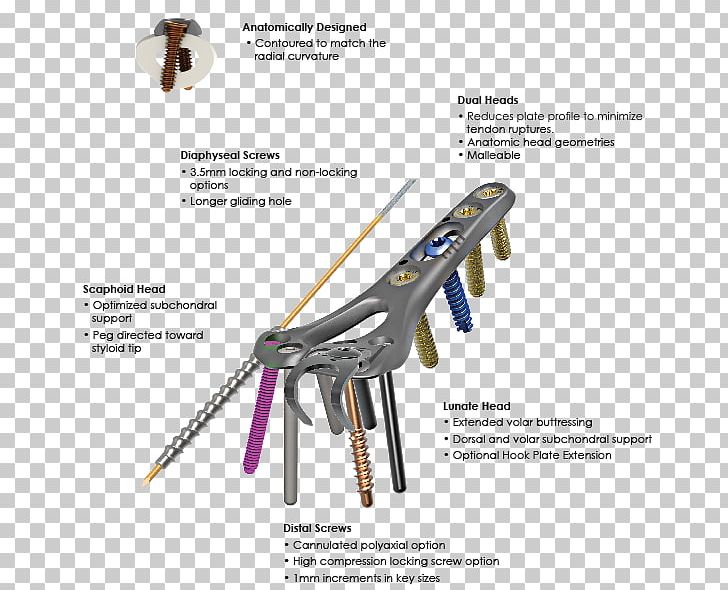 Skeletal Dynamics Inc Bone Radius Distal Human Skeleton PNG, Clipart, Axial Skeleton, Bone, Compression, Distal, Distal Radius Fracture Free PNG Download